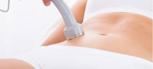 Stretch Marks Removal in Delhi by Laser Technique, Best offers