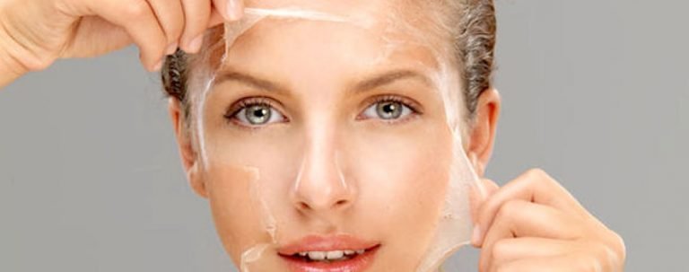 Chemical Peel Treatment Question and Answer