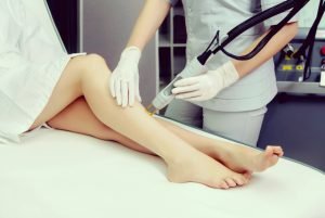 Laser Hair Removal Questions and Answers