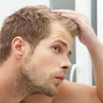 Hair Loss Treatment Question and Answer, FAQ