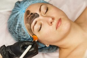 Carbon Laser Facial Procedure And Cost